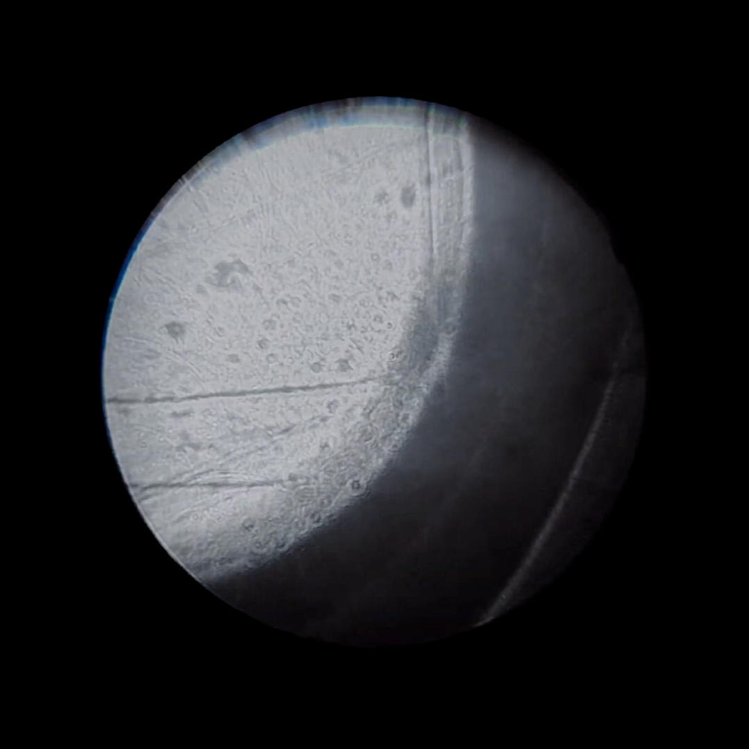 Under the Microscope